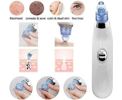 Blackhead Electric Acne Remover Facial Cleaner