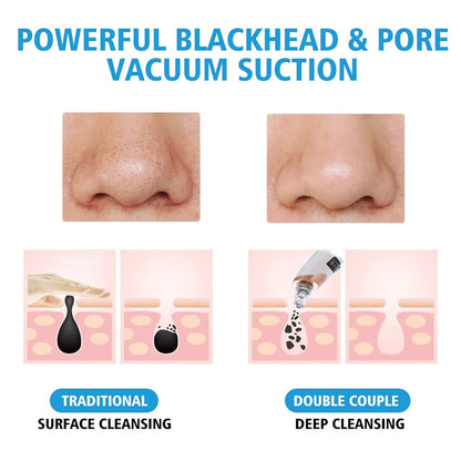 Blackhead Remover Vacuum Pore Cleaner